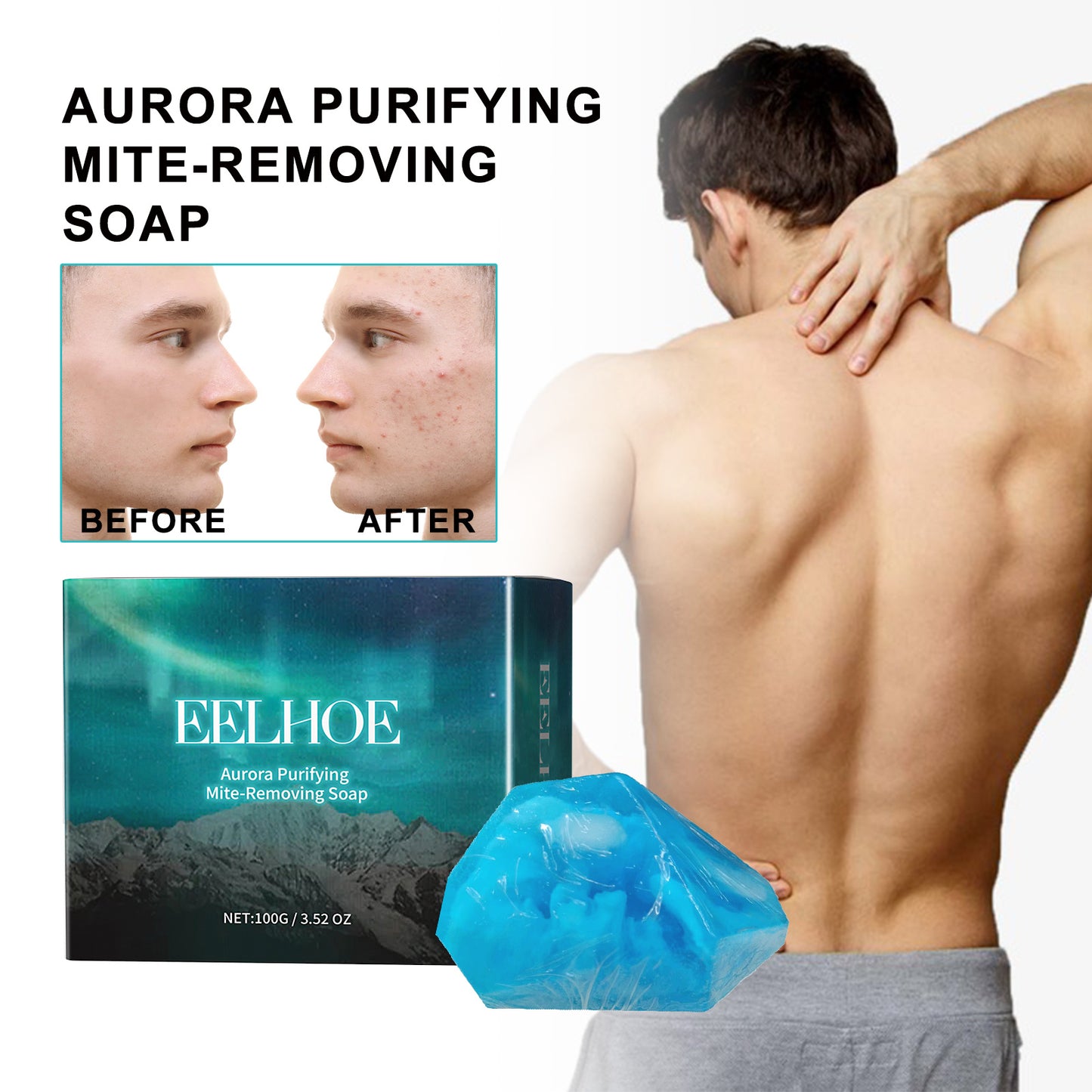 Deep Cleansing Facial Body Skin Lightening Acne Acne Print Multi-effect Cleansing Soap