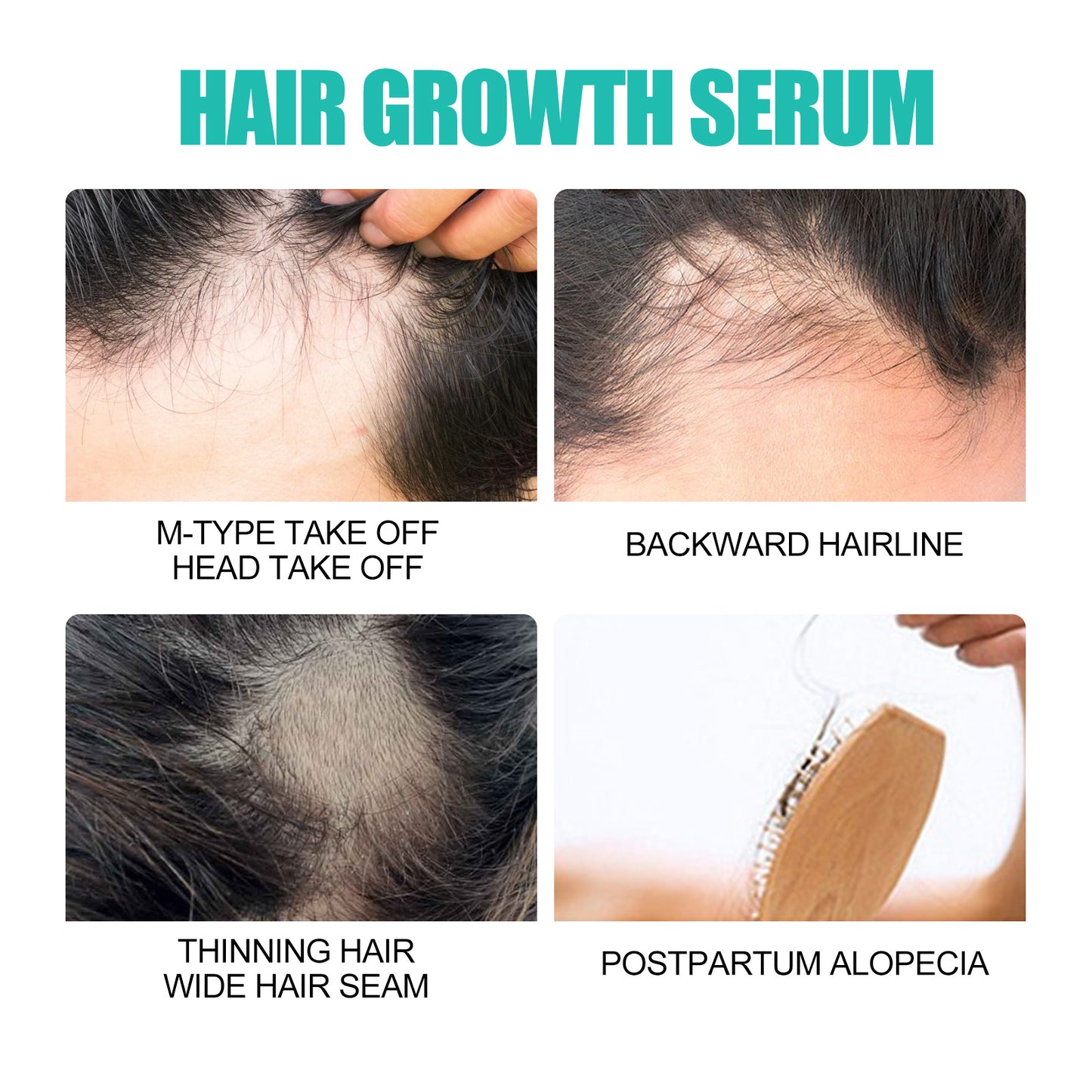 Dry Hairy And Dense Hair Essence
