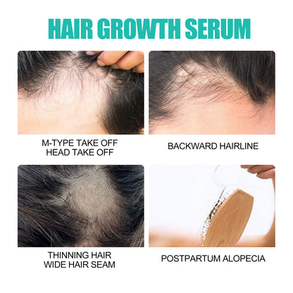 Dry Hairy And Dense Hair Essence