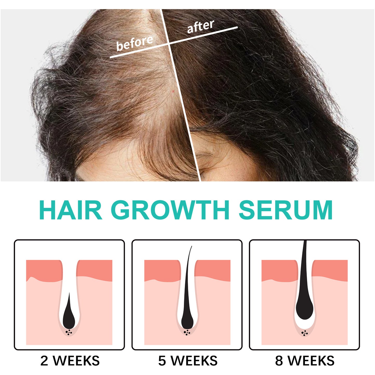 Dry Hairy And Dense Hair Essence