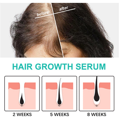 Dry Hairy And Dense Hair Essence