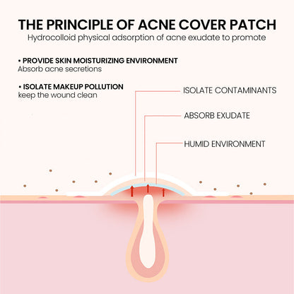 Spotted Acne Scars Cover Acne Patches